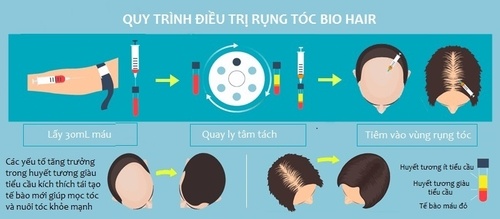 Trị rụng tóc tự thân BioHair | Hết rụng tóc - Tóc mọc dày mượt chắc khỏe 3