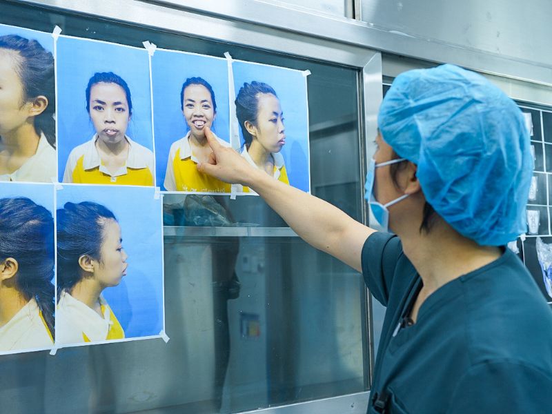 TS. BS Richard Huy nhận định về tình trạng hàm hô của Trà My