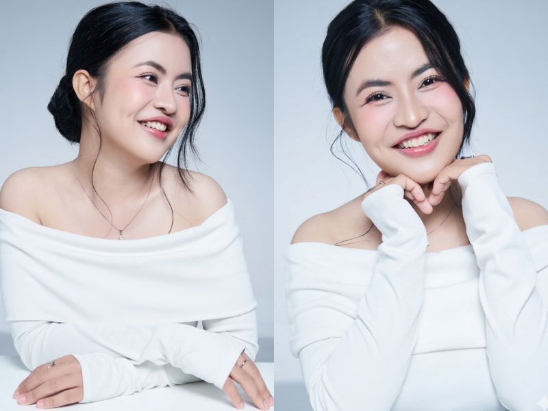 Trà My sau phẫu thuật chỉnh hàm rạng rỡ và xinh đẹp hơn