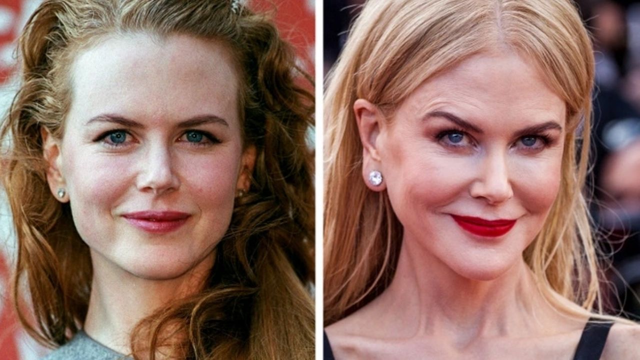 Vì Sao Người Nổi Tiếng Thường Bị Bóc Phốt Trong Ngành Làm Đẹp?